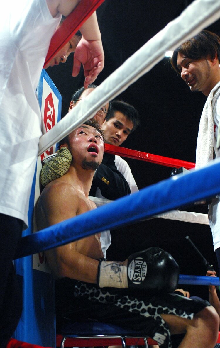 あごが外れて…ぶらんぶらんと」161cmの伝説的ボクサーが“ボコボコに