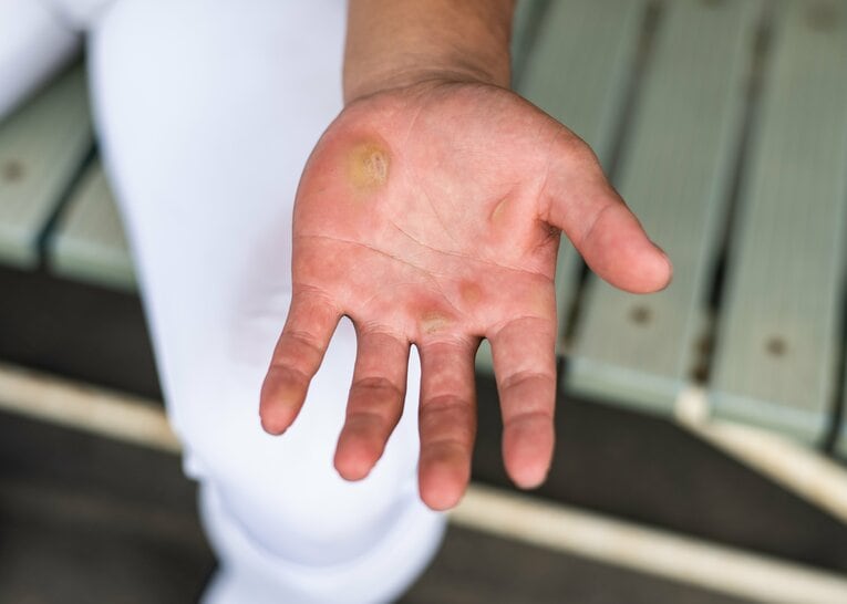 貴重な山田の「手」　©Nanae Suzuki