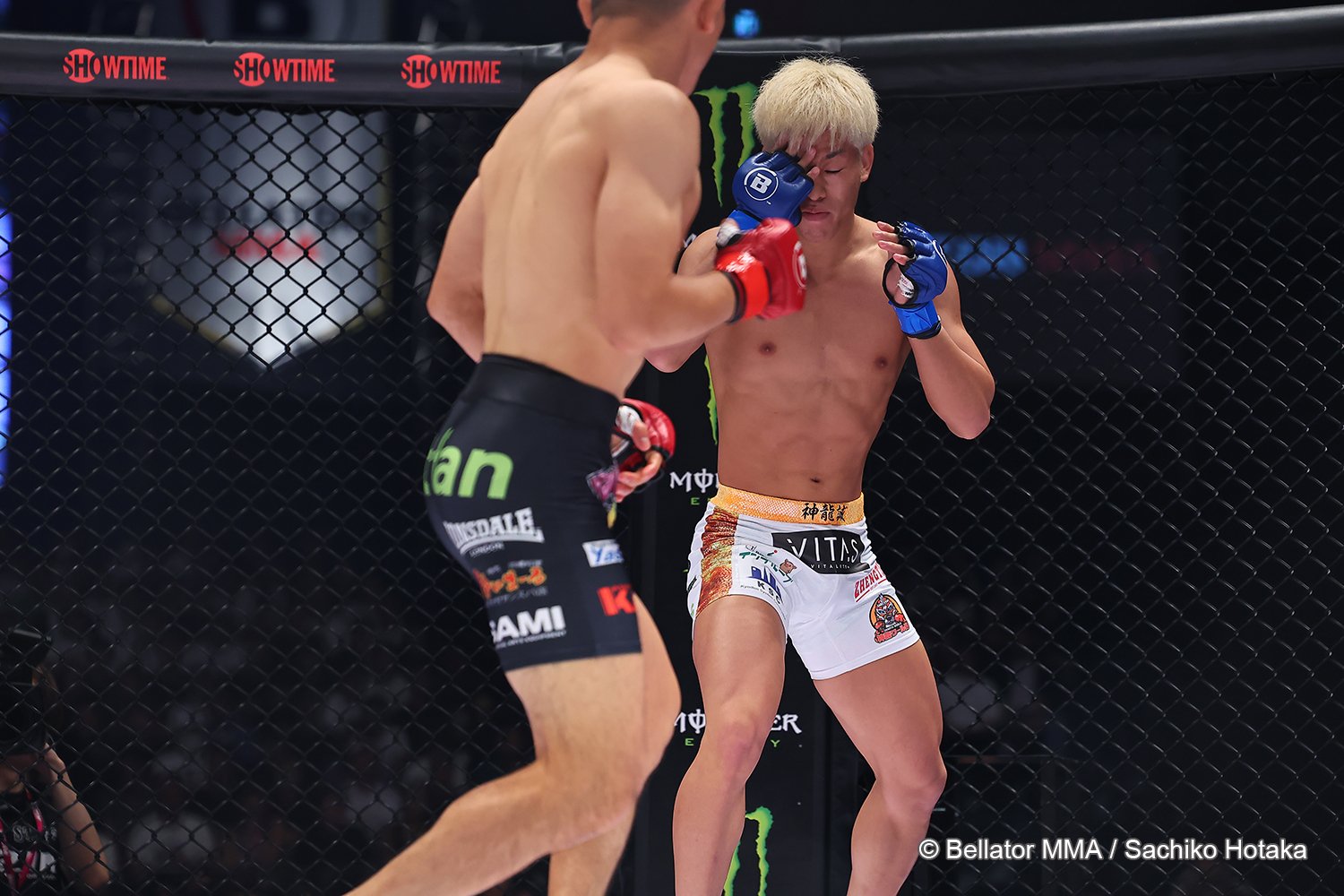 右目を押さえる神龍。右目は見えない状態だったという　©Bellator MMA／Sachiko Hotaka
