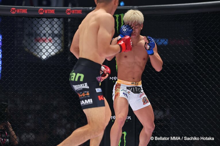 右目を押さえる神龍。右目は見えない状態だったという　©Bellator MMA／Sachiko Hotaka
