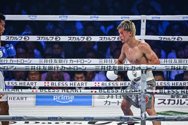 バッティングによって流血した那須川天心　©Takuya Sugiyama