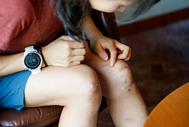 山を走って世界一を目指す女性研修医。医師国家試験前の悪夢を乗り越えて。(2)