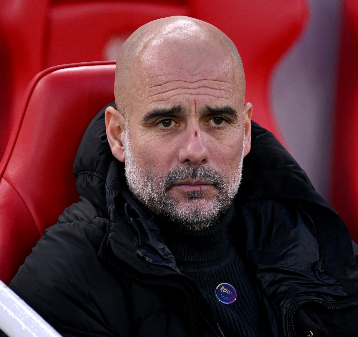 ペップの鼻頭には傷跡が　©Getty Images