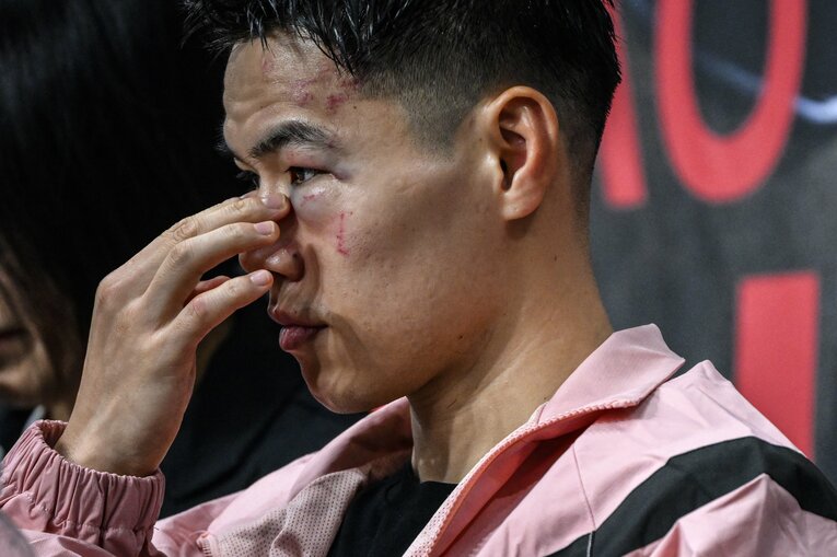 試合後のキム・イェジュン。左目のアザが痛々しい　©Takuya Sugiyama
