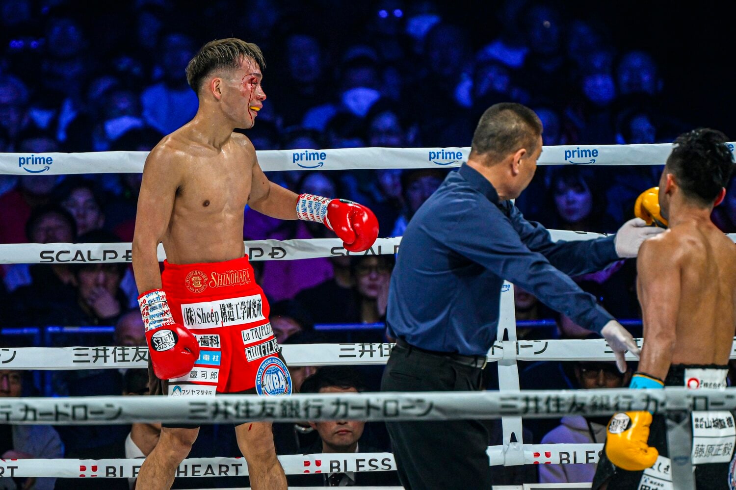 4回、偶然のバッティングで右目上をカットした堤聖也　©Takuya Sugiyama