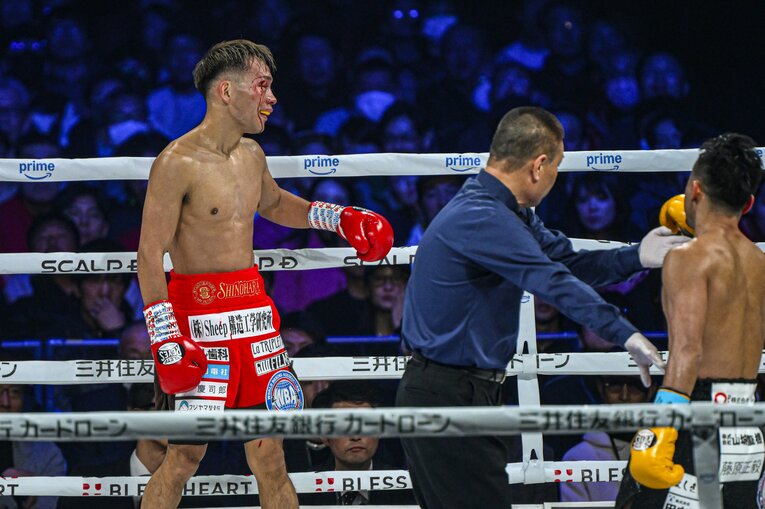 4回、偶然のバッティングで右目上をカットした堤聖也　©Takuya Sugiyama