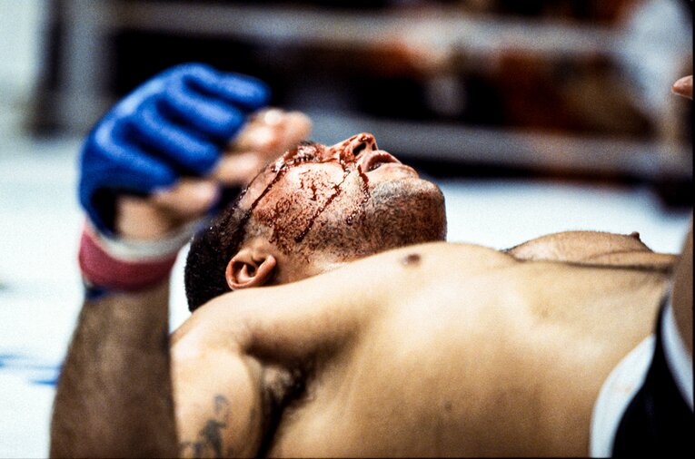 ランデルマンに眉をカットされて出血するニンジャ　©Susumu Nagao