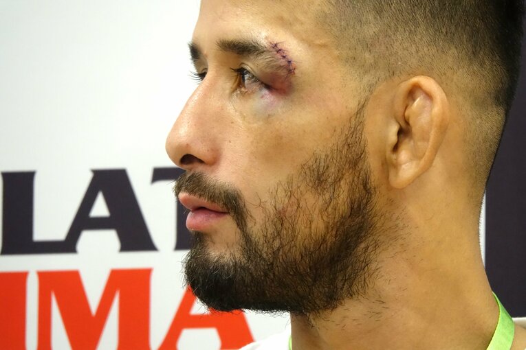 試合後のクレベル・コイケ。左目上の縫い目が痛々しい　©Koji Fuse