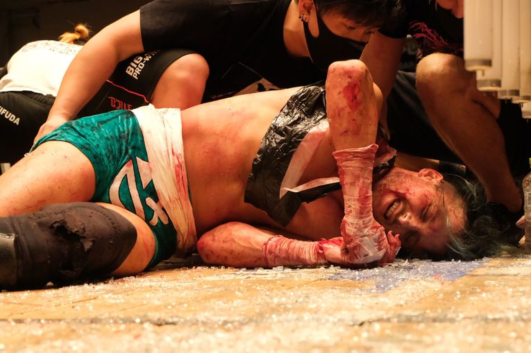 デスマッチファイター・ドリューは血がドクドク流れても試合を止めなかった 「ケガある、傷ある。でもやる。大好きだから」(26)