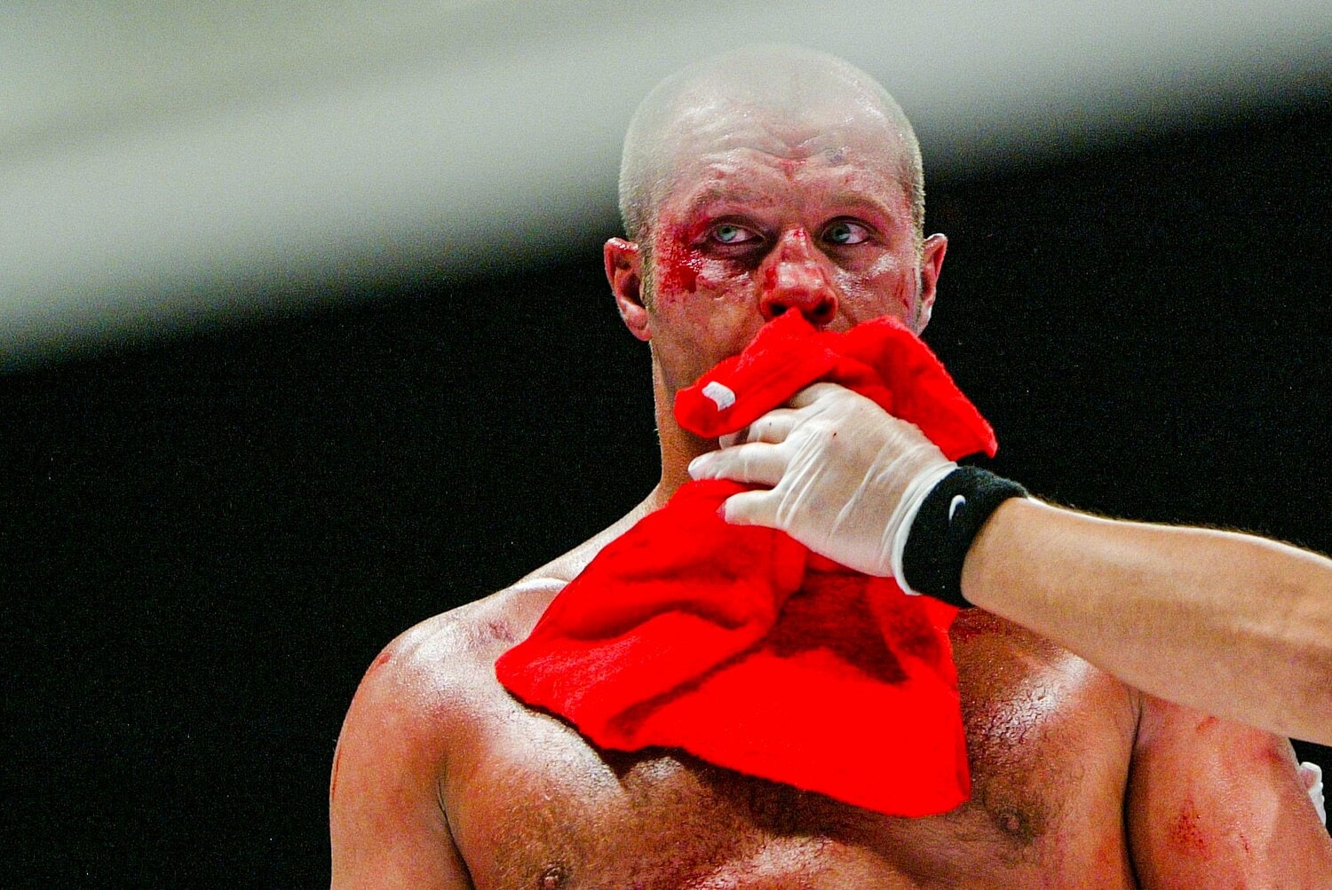 ミルコ戦後のヒョードルの顔は傷だらけだった　©Susumu Nagao