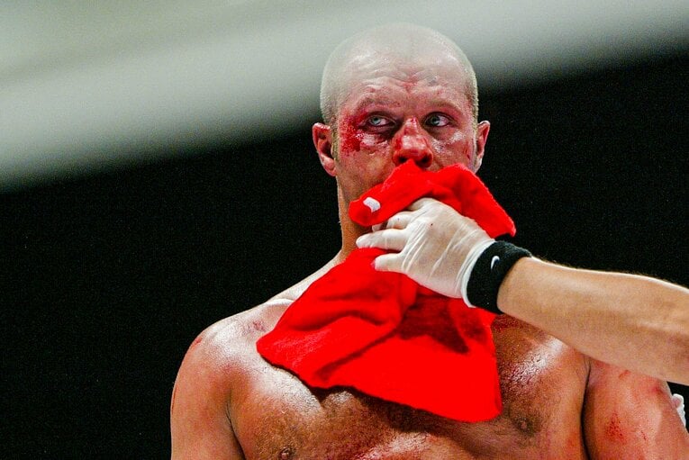 ミルコ戦後のヒョードルの顔は傷だらけだった　©Susumu Nagao