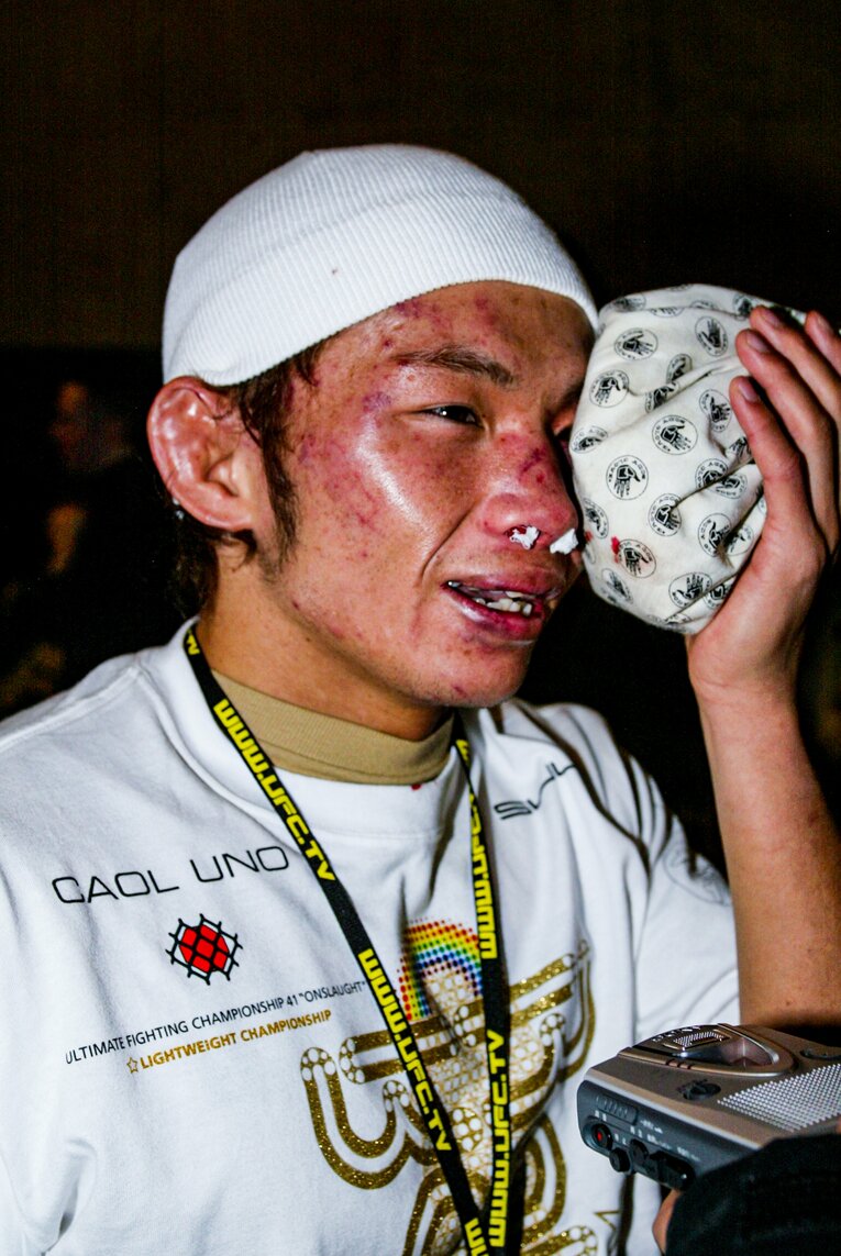 ドローに終わった試合直後、氷のうで顔を冷やす宇野薫　©Susumu Nagao