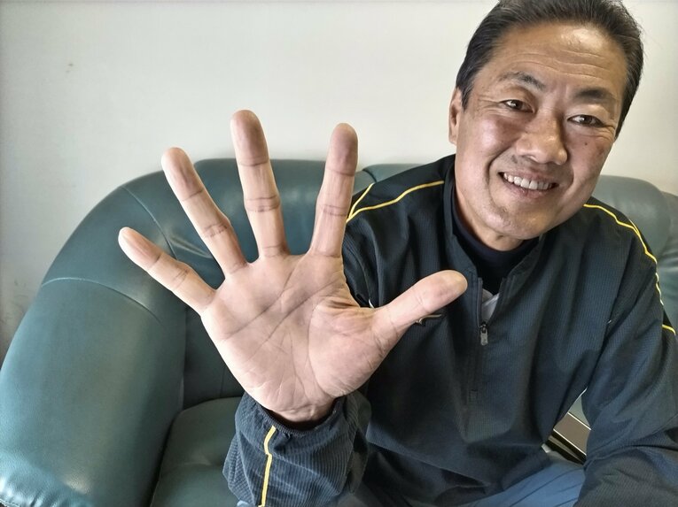 片手で硬球を7個掴めたという高柳さんの「大きい手」