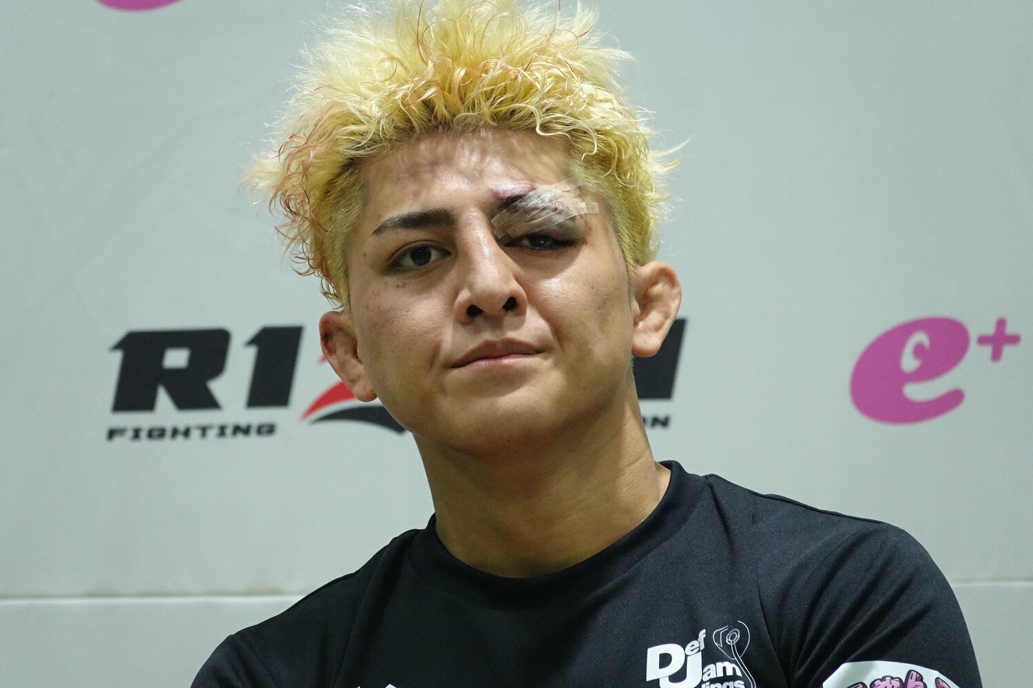 試合後の鈴木千裕。左目上の傷跡が痛々しい　©Koji Fuse