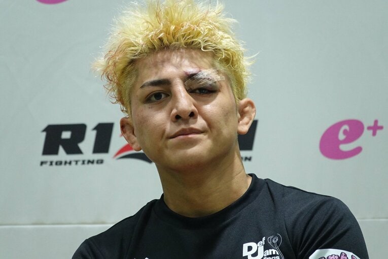 試合後の鈴木千裕。左目上の傷跡が痛々しい　©Koji Fuse