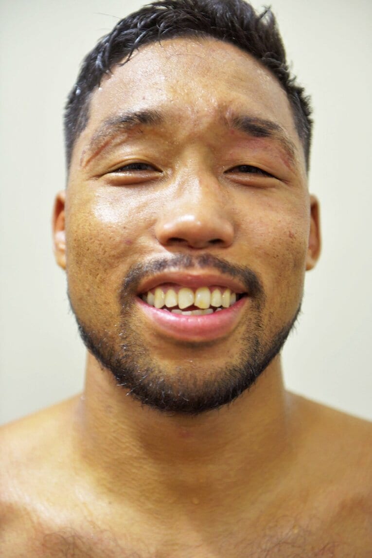 オーストラリアでのデビュー戦を終え、試合後の控室で　©Kokou Sekine