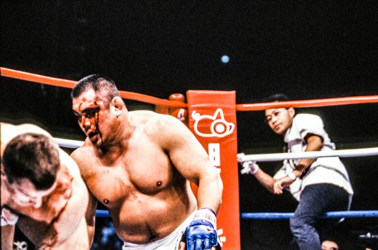 藤田のこめかみ付近がえぐれ、大量に出血　©Susumu Nagao