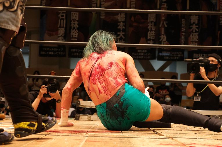 デスマッチファイター・ドリューは血がドクドク流れても試合を止めなかった 「ケガある、傷ある。でもやる。大好きだから」(12)