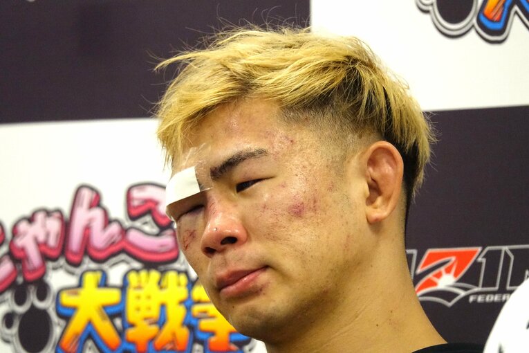 「4針縫った」という右目上の絆創膏が痛々しい　©Koji Fuse