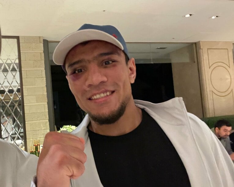 試合の当日夜、記者の直撃に応じたアフマダリエフ。よく見るとアザが目立つ