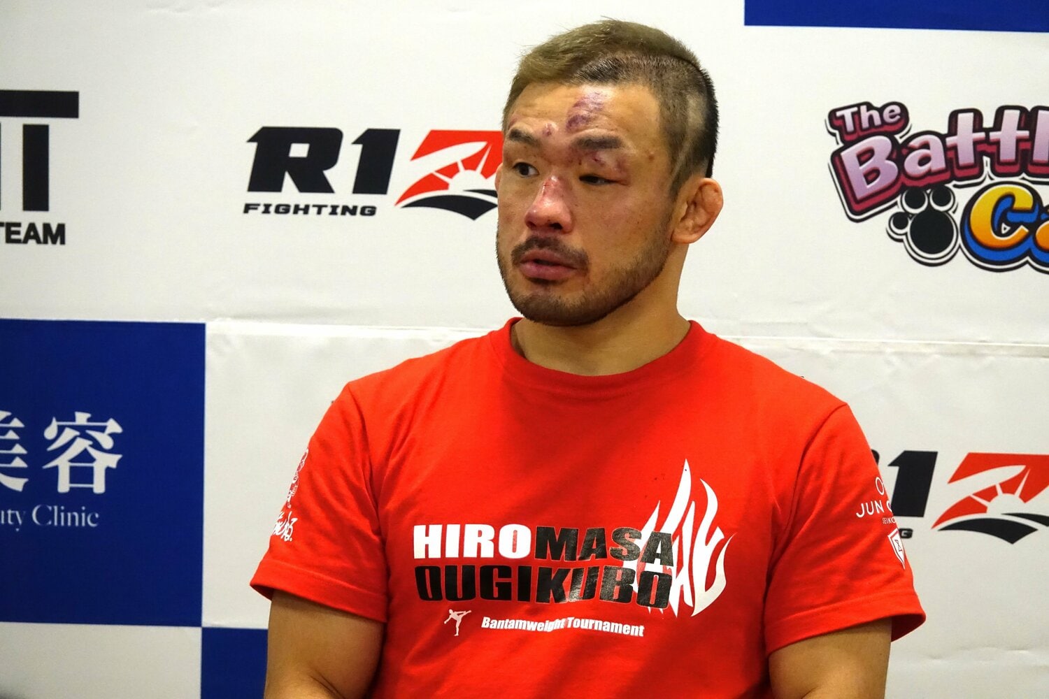 キム・スーチョル戦の直後、傷だらけの顔でインタビューに応じる扇久保博正 ©Koji Fuse