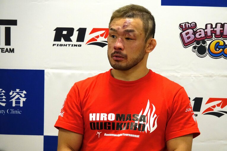 キム・スーチョル戦の直後、傷だらけの顔でインタビューに応じる扇久保博正　©Koji Fuse