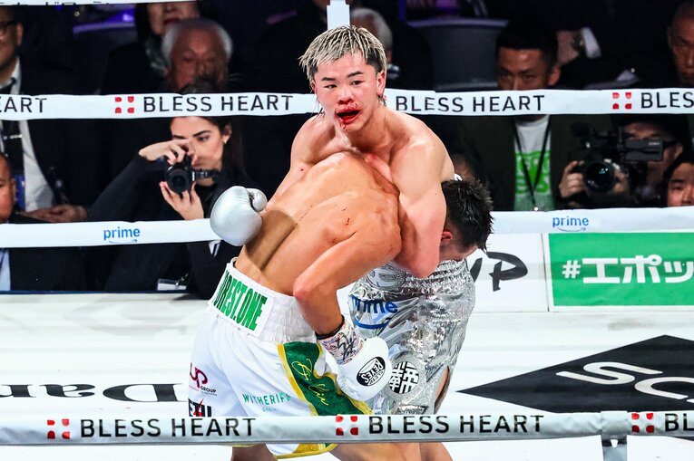 鼻血を流しながらクリンチする那須川天心　©Susumu Nagao