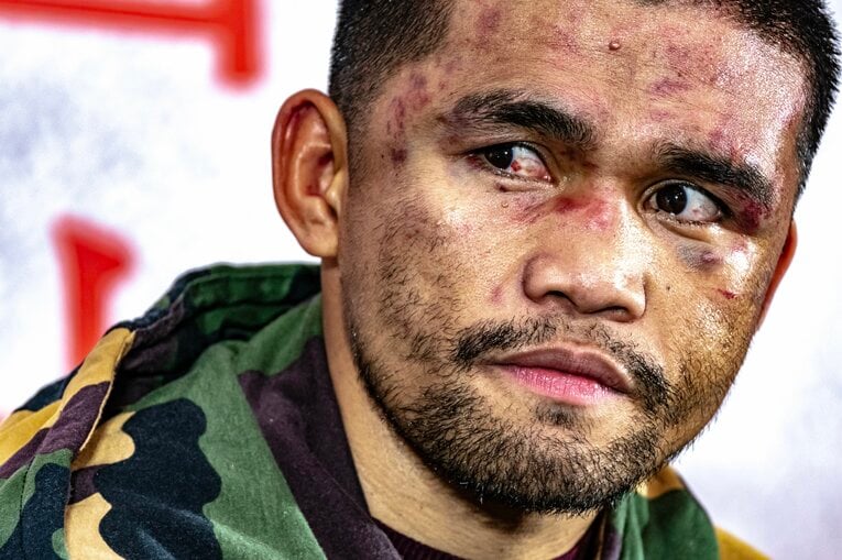 タパレスの顔が井上尚弥のパンチの凄まじさを物語る ／ photograph by Takuya Sugiyama