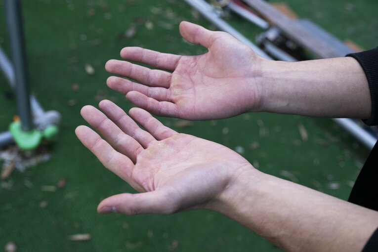 分厚い指の筋肉はオブスタクルスポーツ第一人者である証でもある　©Tadashi Hosoda