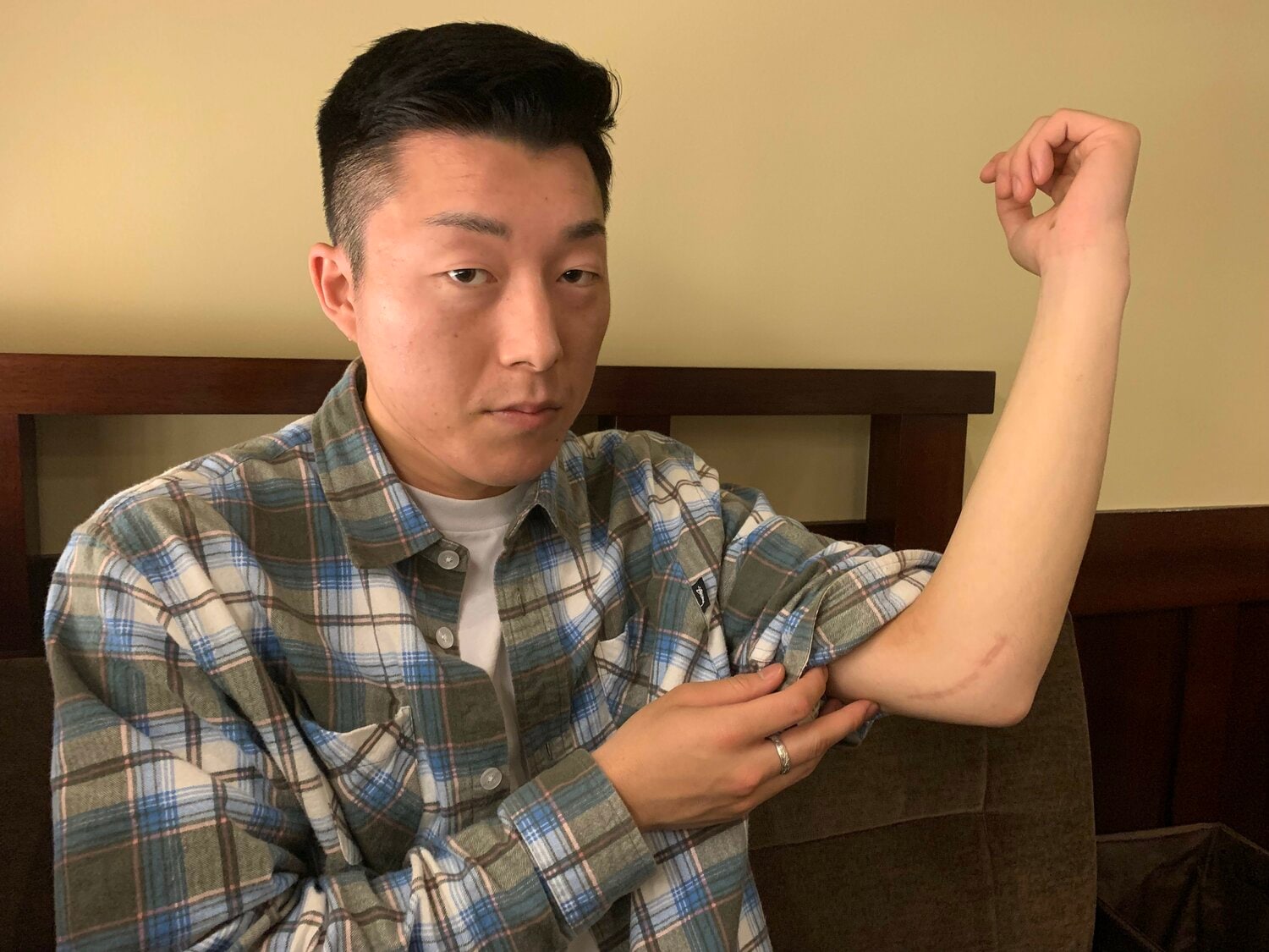 現在もリハビリを続ける川端。左肘には傷跡が残っている　©Katsuharu Uchida